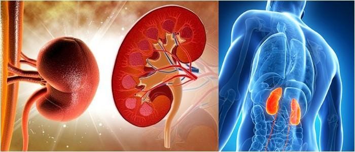 Falla Renal Causas S Ntomas Complicaciones Diagn Stico Tratamiento