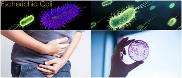 como se cura la escherichia coli