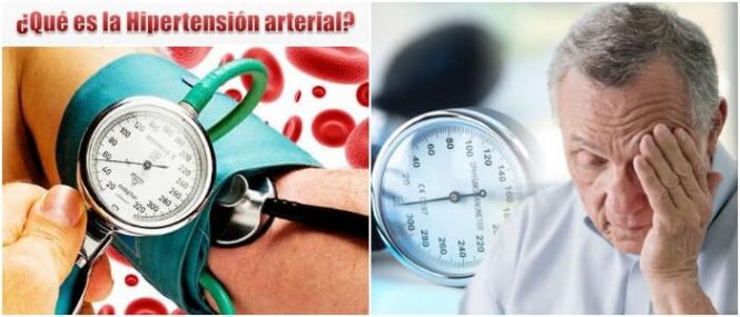 la presión arterial alta e hipertensión gestacional