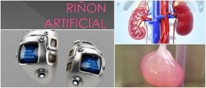 Riñón Artificial: Conoce Todo lo Referente a Este Tipo de Dispositivo y ...