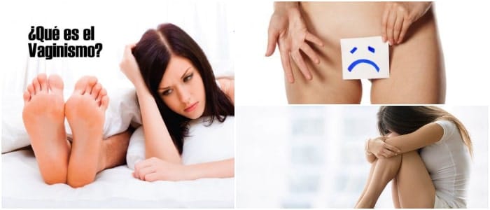 como se cura el vaginismo