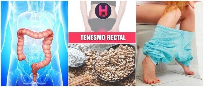 definicion medica del tenesmo