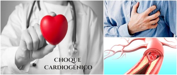 choque cardíaco