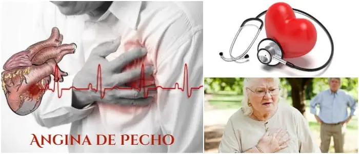 infarto