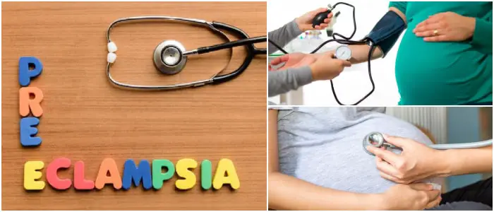 eclampsia