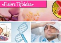 síntomas de la fiebre tifoidea