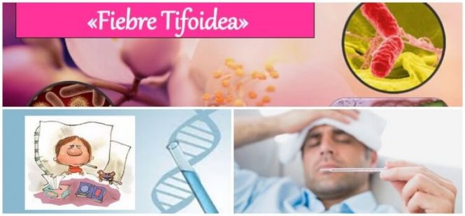 síntomas de la fiebre tifoidea