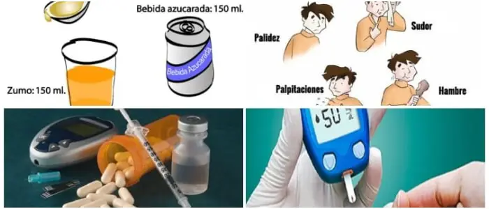 Hipoglucemia Definición Causas Síntomas Factores De Riesgo Diagnóstico Y Tratamiento 3459