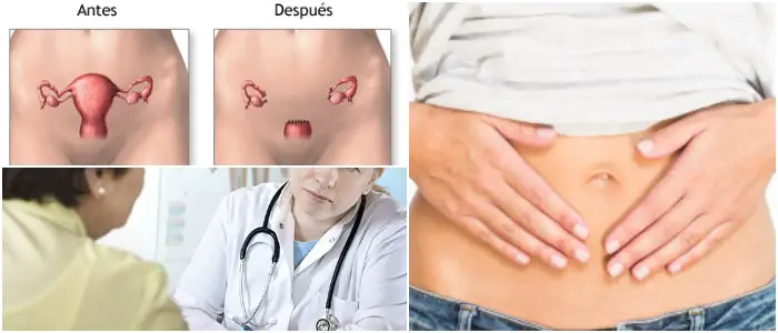 extracción de útero