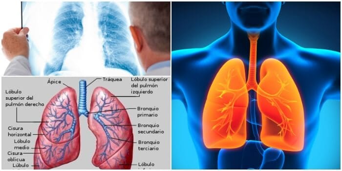 Anatomía del hilio pulmonar y sus afecciones