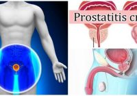 tratamiento para la prostatitis crónica