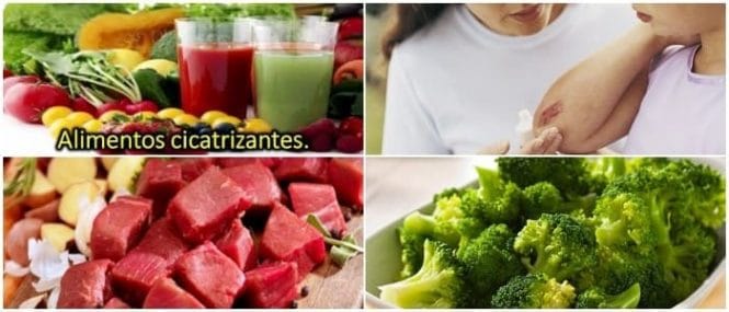 alimentos cicatrizantes de heridas externas
