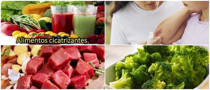 alimentos cicatrizantes de heridas externas