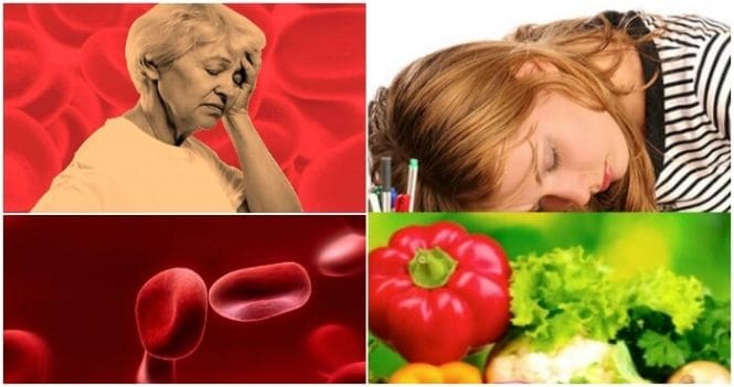 Anemia Hipocromica: ¿Que es? Causas, Síntomas y ...