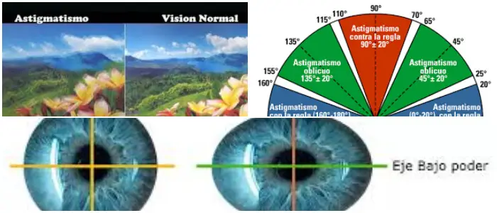 Cura del Astigmatismo
