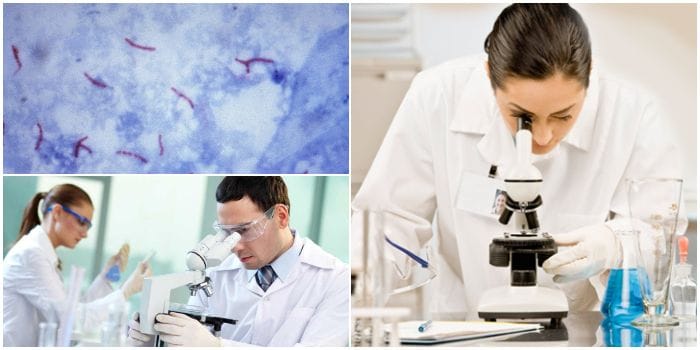 Articulo sobre baciloscopia