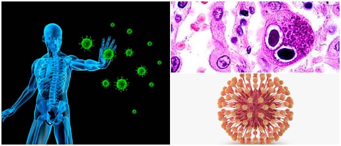 Citomegalovirus anticuerpos