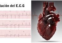 electrocardiograma interpretacion