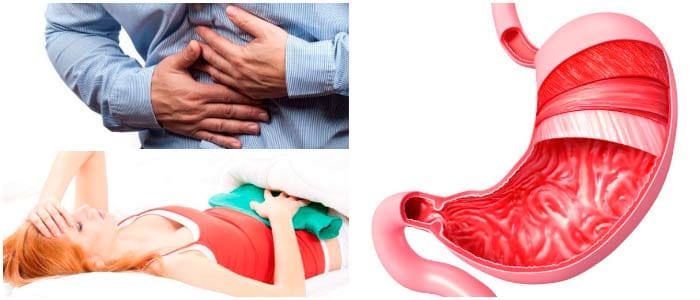 Epigastralgia: Causas y Prevención De Los Problemas Asociados Con La ...