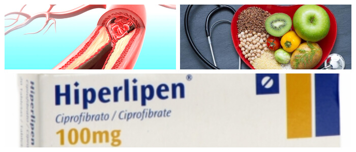 composición del hiperlipen