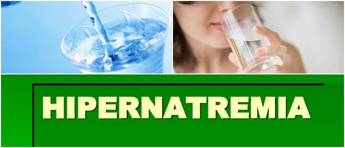 hipernatremia bases medicina