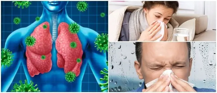 Infecciones Respiratorias Agudas Neumonía Pleuresía Tuberculosis E Influenza Arriba Salud