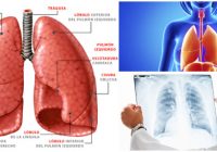 Definición de los lobulos pulmonares