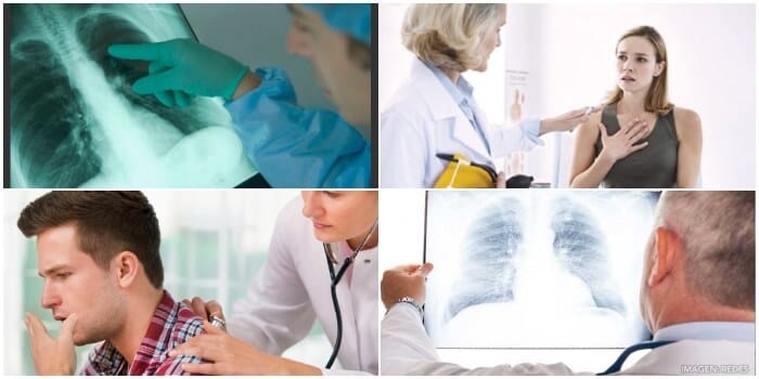 significado y definición de pulmonía