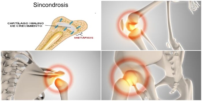 Características de la sincondrosis