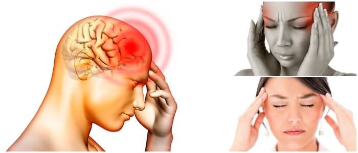 Existen varios tipos de migraña