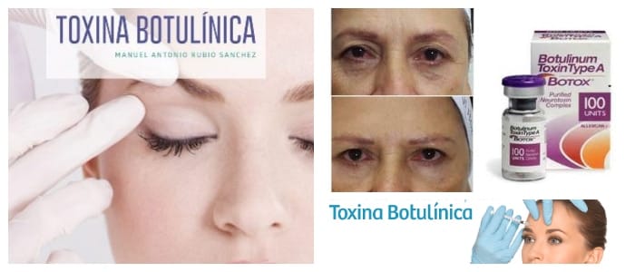 toxina botulínica bruxismo