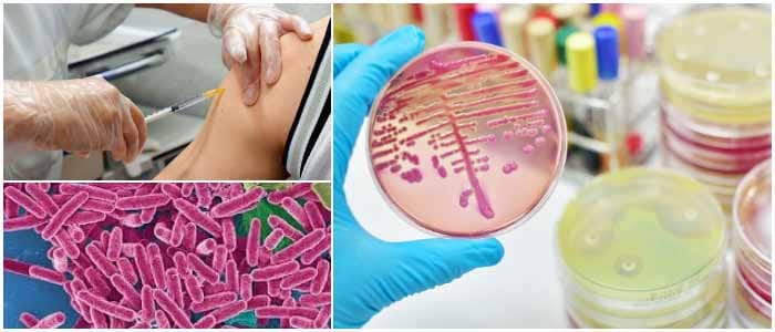 amikacina bactericida o bacteriostatico