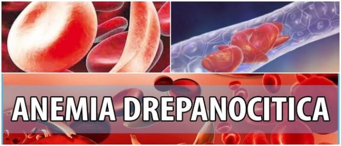 anemia drepanocítica bioquimica