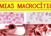 definición de la anemia microcitica