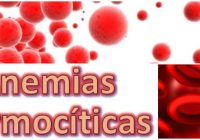 causas de la anemia normocitica