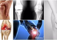 Causas de la artrosis de rodilla.