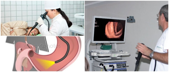 boroscopio y endoscopio