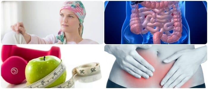 tratamiento para el cáncer de intestino grueso