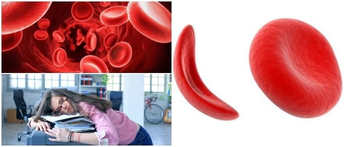 drepanocitosis y genetica