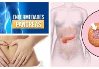 enfermedades comunes del páncreas