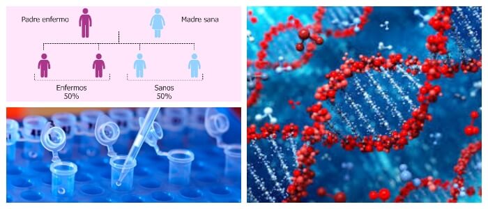 Enfermedades Genéticas Definición Tipos Herencia Y Genoma Humano Arriba Salud