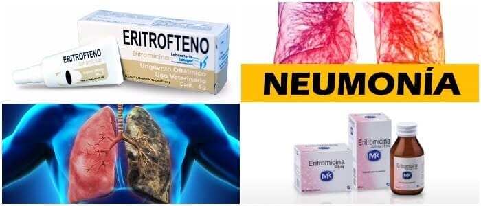 ¿Para qué sirve la Eritromicina?