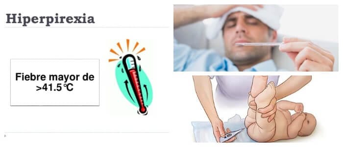 hiperpirexia por calor