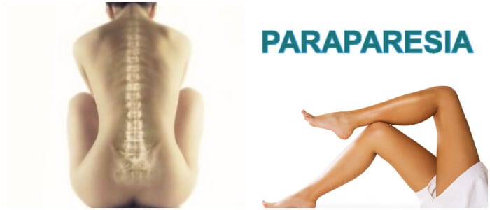 debilidad muscular en las piernas