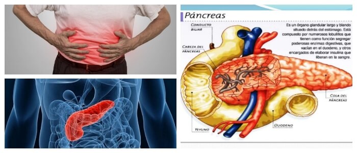 causas de trastorno del pancreas