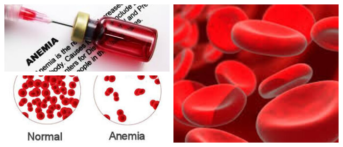 tratamiento de la anemia con hierro