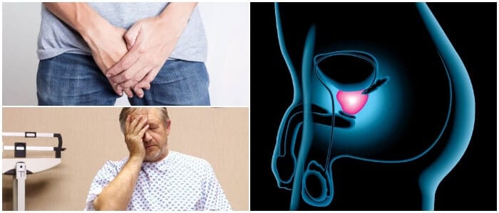 biopsia de cáncer de próstata