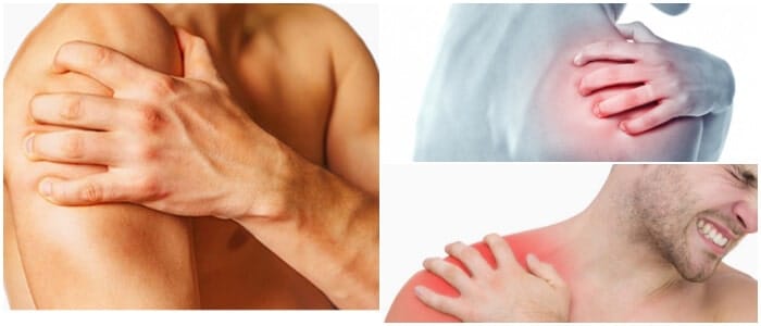 dolor de hombro bursitis
