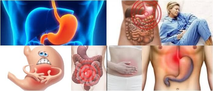 causas del dolor epigastrico