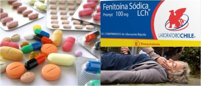 efectos secundarios de la fenitoina